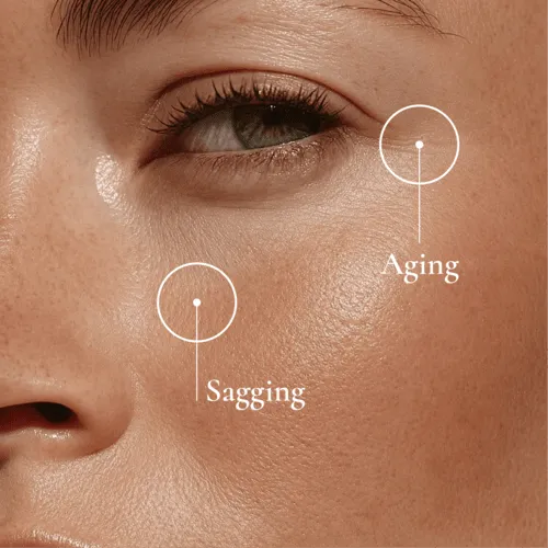 Aging concern