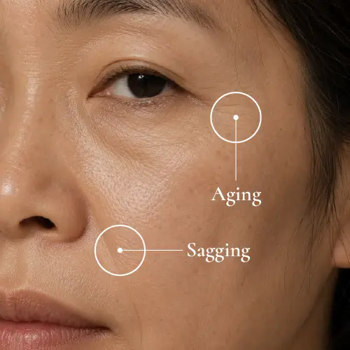 Aging concern