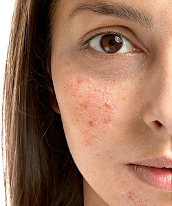 science-baked-staple-skincare