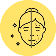 Fades dark spots