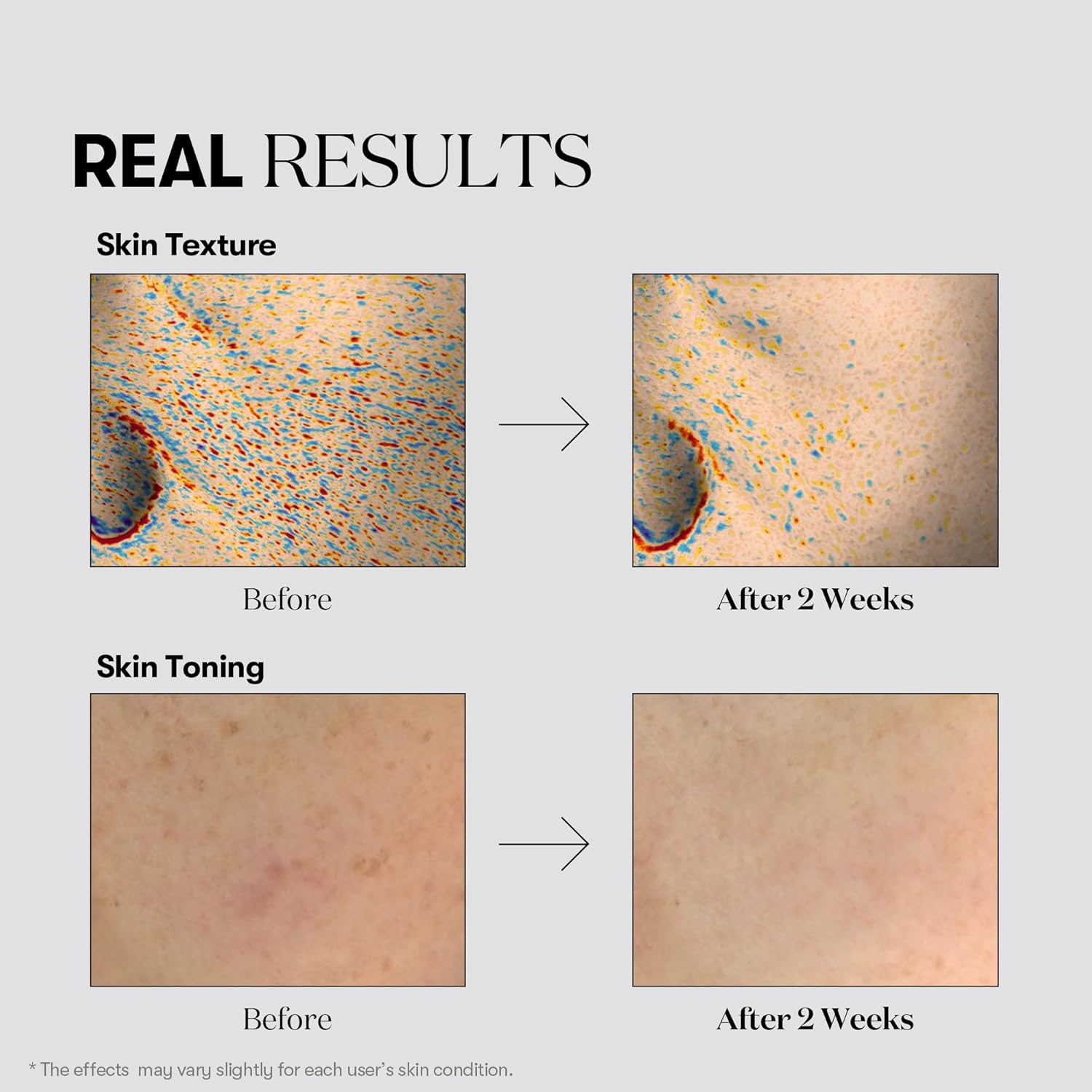 Buy VT Cosmetics TX-Toning Daily Mask | Skin Toning | Brightening