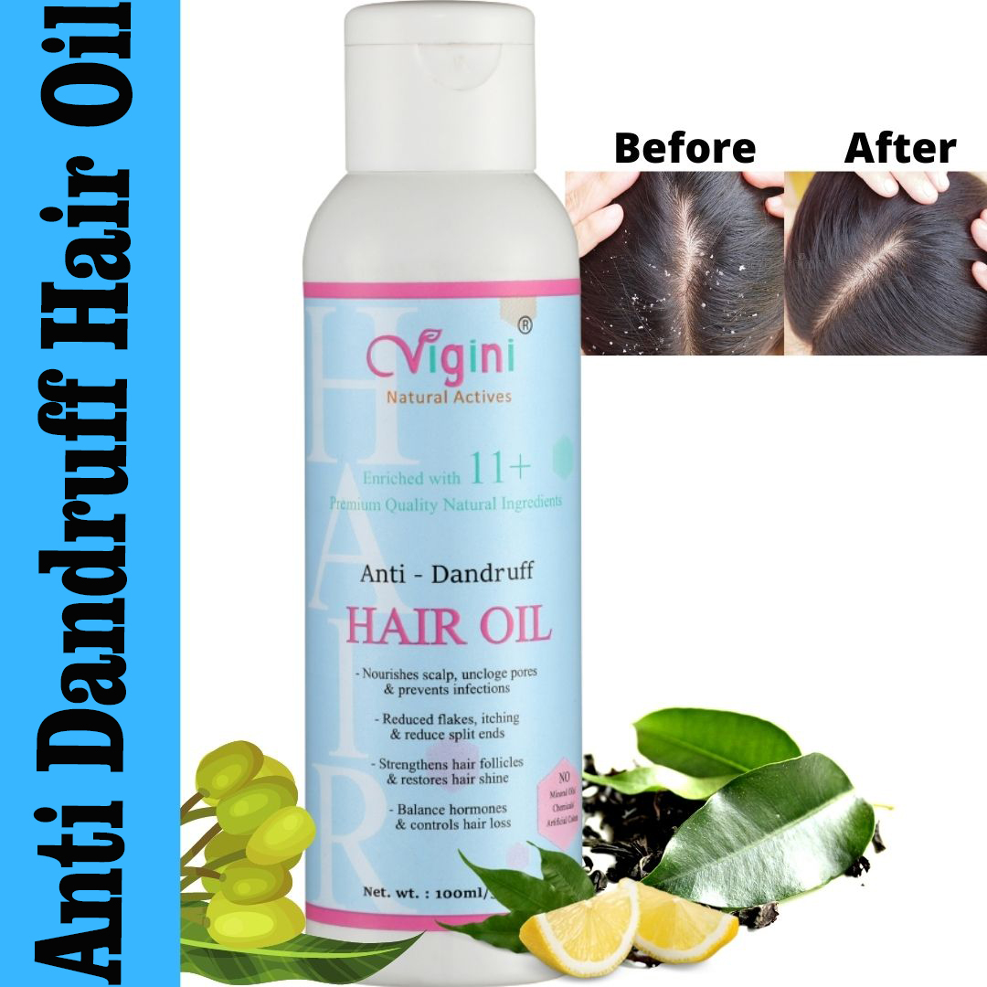 Vigini Natural AntiDandruff Itchy Scalp Hair Care Oil Provides Hair