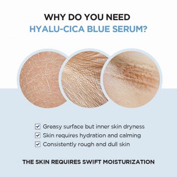 SKIN1004:  Madagascar Centella Hyalu-Cica Blue Serum 50ml