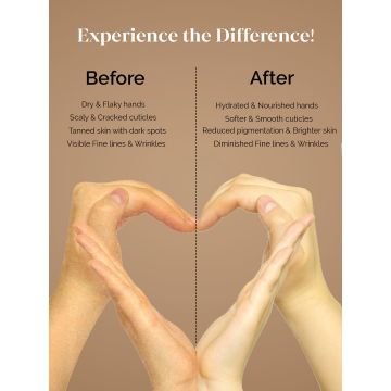 LuxaDerme: Hand Hydration Gloves 15ml