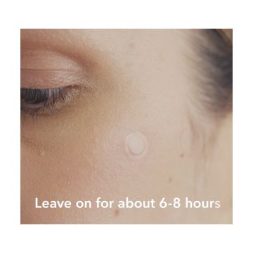 Spot Patch: PM Original 42 Acne Pimple Patches - Pack of 2 (42 Pcs each)