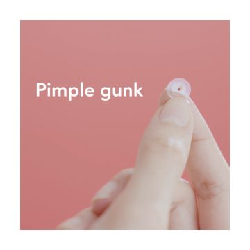 Spot Patch: PM Original 42 Acne Pimple Patches - Pack of 2 (42 Pcs each)