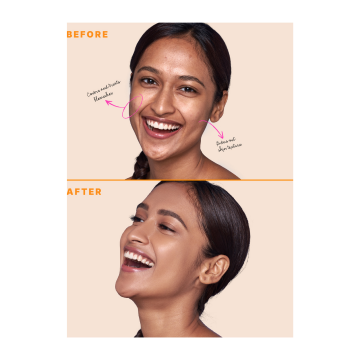 Type Beauty: Zit Quit Concealer, For Acne & Uneven Texture - Biscotti - 8Ml