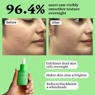 Foxtale: 2% Salicylic Acid and 2% Glycolic Acid Serum - 30ml