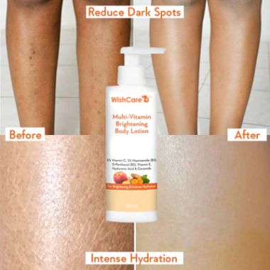 WishCare: Multi-Vitamin Brightening Body Lotion - 200ml