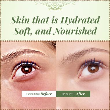 VITMINVEDA: Pure Natural Aloe Vera Gel - 100 gm