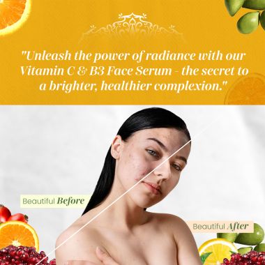 VITMINVEDA: Vitamin C & B3 Face Serum for Natural Glow - 30 ml