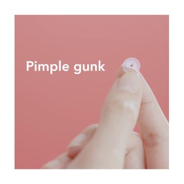 Spot Patch: PM Original 42 Acne Pimple Patches - 42Pcs