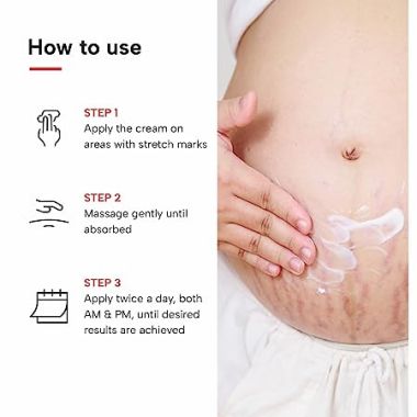 Dermatouch: Bye Bye Stretch Mark Cream - 125gm