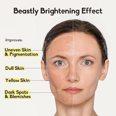 VariHope: 8 Days Brightening Serum With Pure Vitamin C - 15gm
