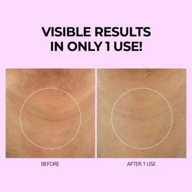 VariHope: Biotics Firming Neck Wrinkle Patch - 5 Patches