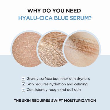 SKIN1004: Madagascar Centella Hyalu-Cica Blue Serum - 50ml