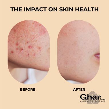 Ghar Soaps: Face Clean Towel - 10 Pieces