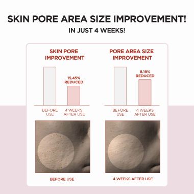 SKIN1004: Madagascar Centella Poremizing Clear Toner - 210ml