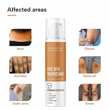 Dermatouch: Bye Bye Nigricans Cream - 50gm