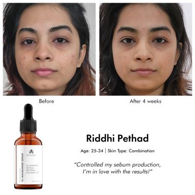 Suganda: 5% Niacinamide Serum - 30ml