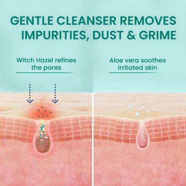 The Skin Story: No Rinse Foam Cleanser - 50ml