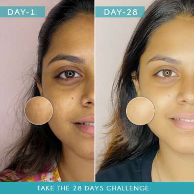 AULI: Aloe Vera and Turmeric Gel - 60gm
