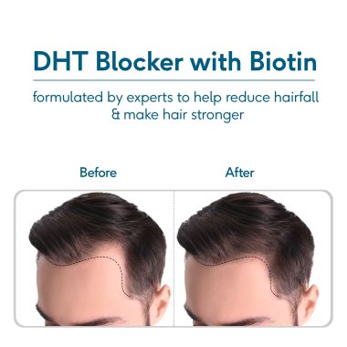 HK Vitals: DHT Blocker with Biotin, Stinging Nettle and Soya Protein, Helps Reduce Hair Fall, Stimulates Hair Growth, 60 Tablets