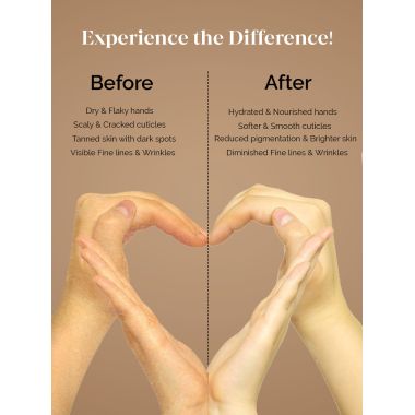 LuxaDerme: Hand Hydration Gloves 15ml