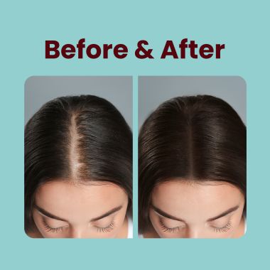 Gytree: The Total Hair, Skin & Nail Support Biotin Gummies