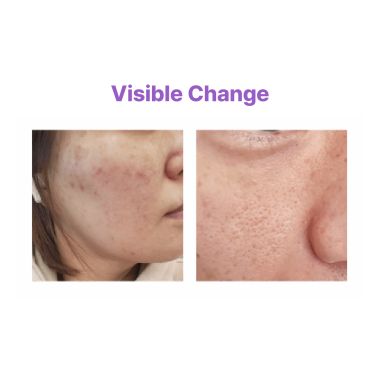 AUIO: Niacinamide 20% + Zinc 1% Serum