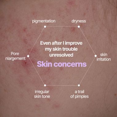 AUIO: Niacinamide 20% + Zinc 1% Serum