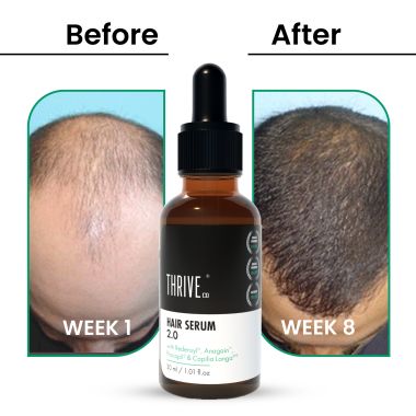 Thriveco: Hair Growth Serum 2.0, 30 ml