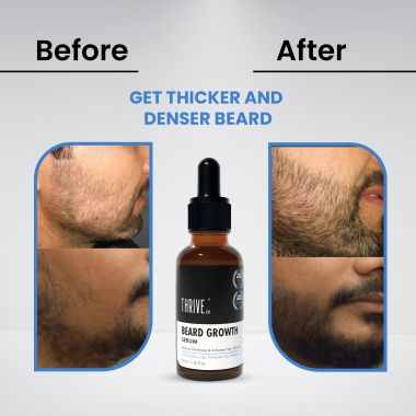 Thriveco: Beard Growth Serum For Men - 30 ml