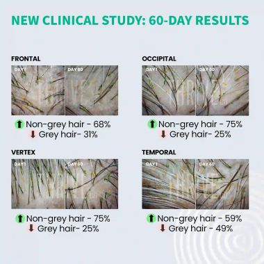 Thriveco: Hair Prime Serum, 30 ml
