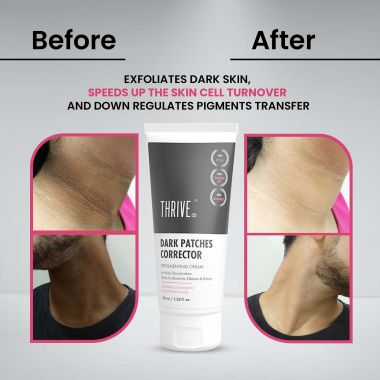 Thriveco: Dark Patches Corrector - 100ml
