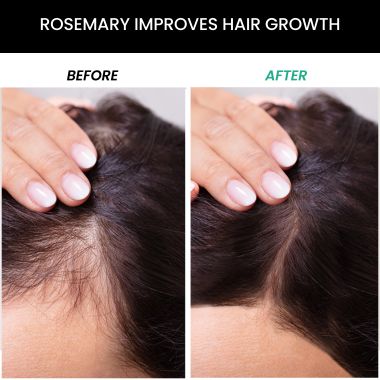 Thriveco: Rosemary Conditioner, 250ml