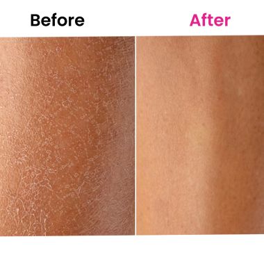 Thriveco: Skin Expert Oil, 80ml