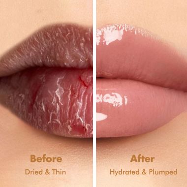 Conscious Chemist: Multi Peptide & Shea Butter Infused Lip balm With SPF 15 :- Vanilla (15g)