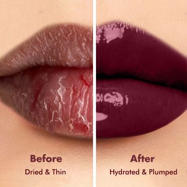 Conscious Chemist: Multi Peptide & Shea Butter Infused Lip balm With SPF 15 Lip balm:- Raspberry Gummy (15g)