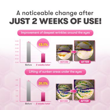AUIO: Slow- Ageing Needle Age Shot 300 New Packing [CLONE]