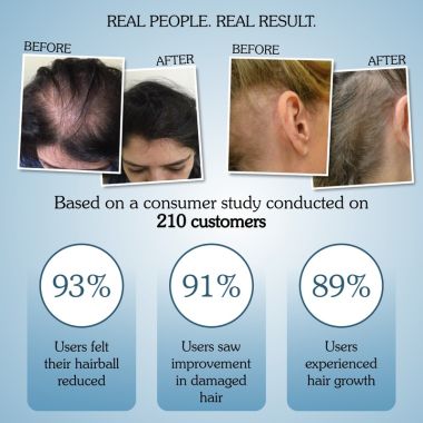 Bake Cosmetics: Rosemary Water Hair Growth Spray with Multi Peptides for Hair Fall Control,Damaged Hair & Hair Growth