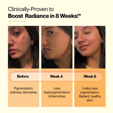 SETU: Skin Renew Glutathione - Orange Flavour -15 Effervescent Tablets
