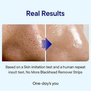 One-Day's You
: P.Z. SSOC SSOC No More Blackhead