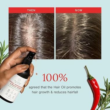 Juicy Chemistry: Chilli, Horsetail & Blackseed Hair Oil, 100 ml | Hair Growth Oil Enriched with Rosemary Oil & Kalonji Oil to Control Hair Fall | Clinically Proven Hair Growth Oil with Natural DHT Blockers for Men & Women | For Healthy Hair, Scalp Nourishment & Hair Grow