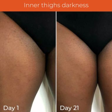 Skinvest: Light it up Sunscreen body spray - SPF 40 PA ++++ 100ml | with Kumkumadi Tailam | De-tans & Hydrates | Brightens Skin Tone | Removes Pigmentation | For All Skin Types | No white cast | No alcohol | Dermatologist Tested