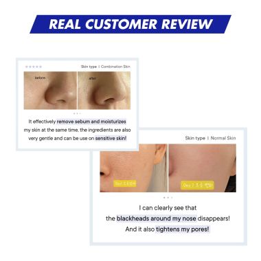 One-Day's You
: No More Blackhead Pore Gel Cream