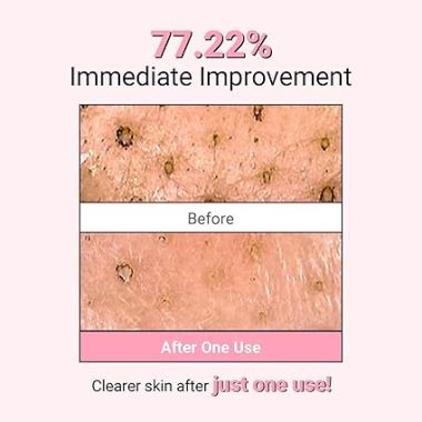 neaf neaf: Kaolin Purifying Wash Off Mask (110g)