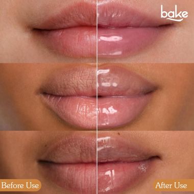 Bake Cosmetics: 10% L-Ascorbic Acid Tinted Butter Brightening Lip Balm SPF 55 PA++++ with Hyaluronic Acid 24 Hour Moisturization For Dark, Pigmented, Dry & Chapped Lips
