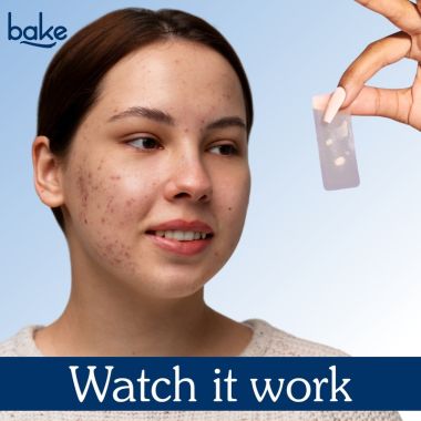 Bake Cosmetics: 2% Salicylic Acid Hydrocolloid Acne Patch XL Pimple Patch for Blackheads & Acne-10 Strips