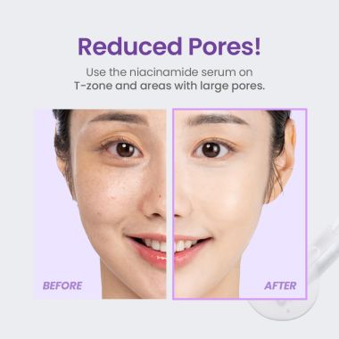 Tirtir: Niacinamide 20% Serum 30ml